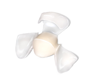 미니쉬 윙 브릿지